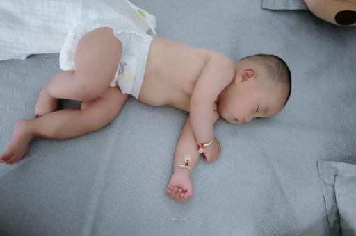 乌鲁木齐宝宝头上长痱子